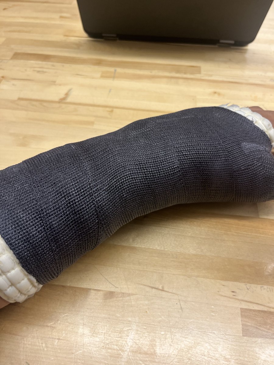 Hurt it in practice.
Played in the game the next day.
Found out it was broken during the bye week.
Doc said I can play.
Thanks for all the 'Get Well' Wishes.

I stay ballin'.