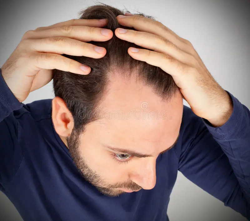 simon_troupe's tweet image. ❗️Hair-Loss Drug Finasteride Tied to Depression, Anxiety, and Suicide
A study by Brezis finds alarming results and calls for safer treatments.
@McCulloughFund @P_McCulloughMD
Read more:
thefocalpoints.com/p/hair-loss-dr…