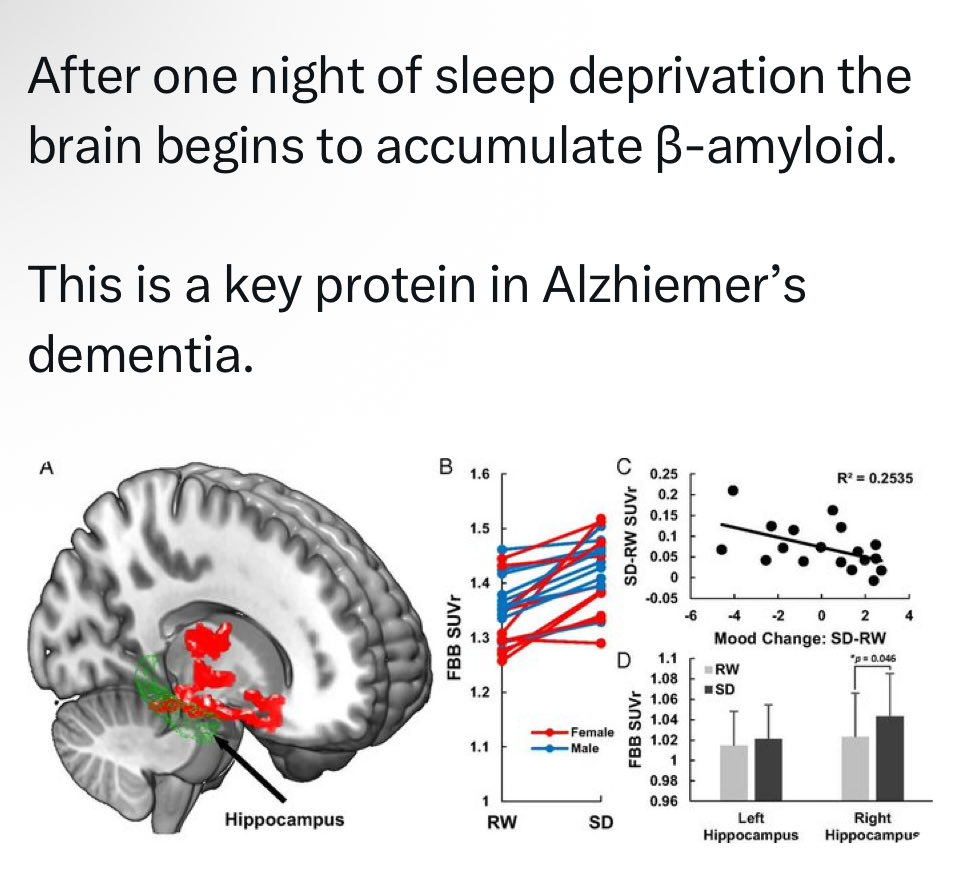 Jen_Angela's tweet image. Me last for 5 nights finishing a grant application😵‍💫