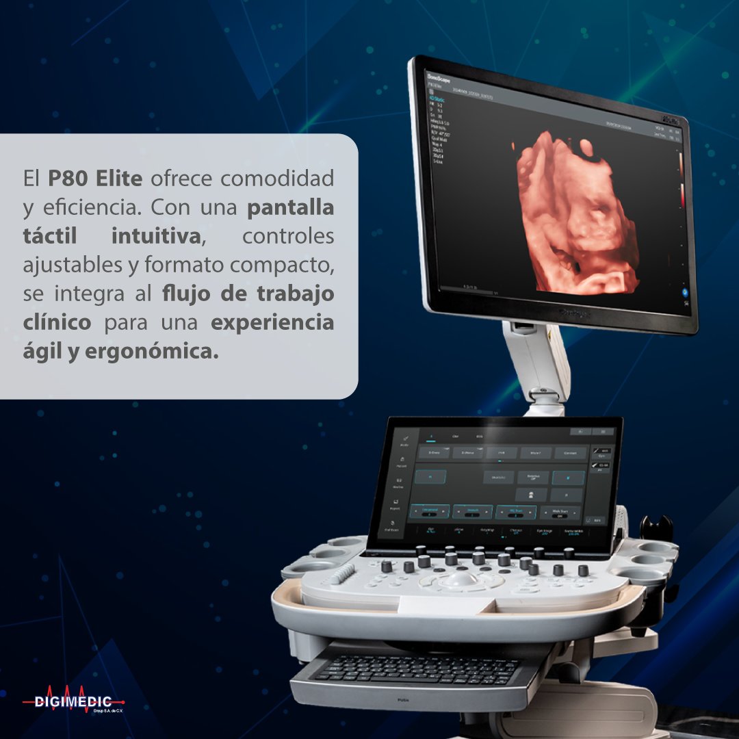 ¡Lleva tu diagnóstico al siguiente nivel con el nuevo P80 Elite!

Potenciado con inteligencia artificial, calidad de imagen ultranítida y un diseño compacto y ergonómico que se adapta a tu ritmo clínico.

Precisión, velocidad y tecnología al servicio de tu práctica médica.