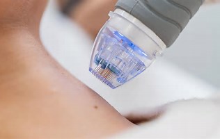 jimgrimes's tweet image. 🚨 FDA Warning: Serious complications—including burns, scarring, fat loss &amp;amp; nerve damage—have been reported with certain uses of radiofrequency (RF) microneedling devices. These are medical procedures, not for at-home use.
📎 Learn more
#FDA #Microneedling #HealthAlert