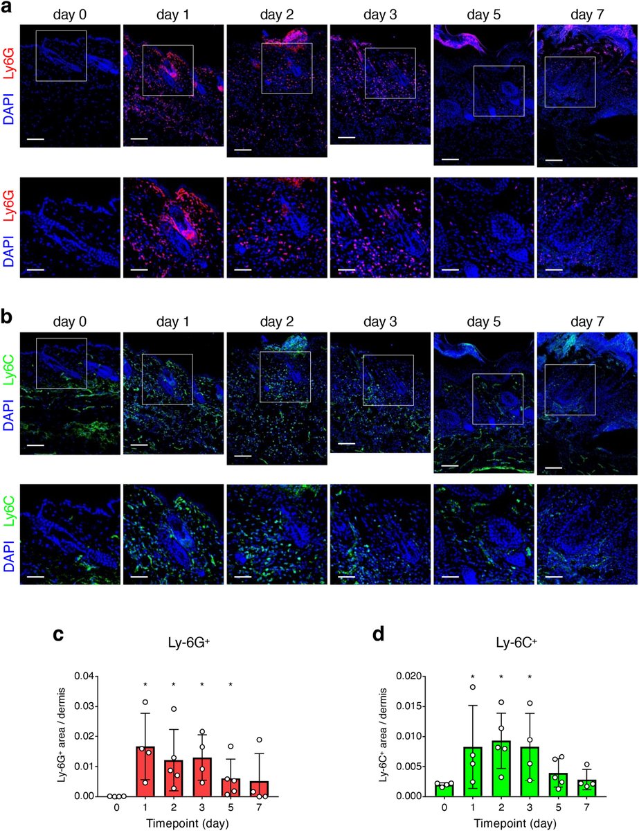 We know squaric acid can work for #alopeciaareata--but how? New insights &amp; what they tell us about the pathology of the disease ow.ly/73Qi50Xctzk #medderm #dermtwitter