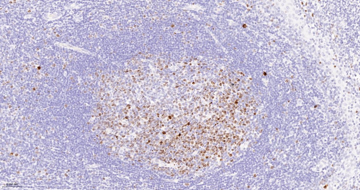 This month’s IHC spotlight features bsm-60737R (CD11b), bsm-54767R (CD44), bsm-54132R (AIF1), and bsm-52455R (Ki-67)— critical markers for tracking immune activation, inflammation, microglial response, and cell proliferation. 

Visit hubs.ly/Q03NZWQc0 to learn more.
