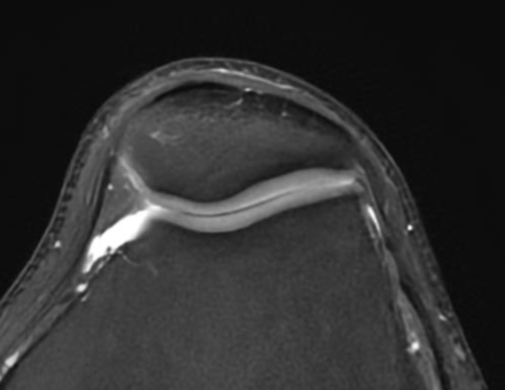Mexican Ortho tweet media