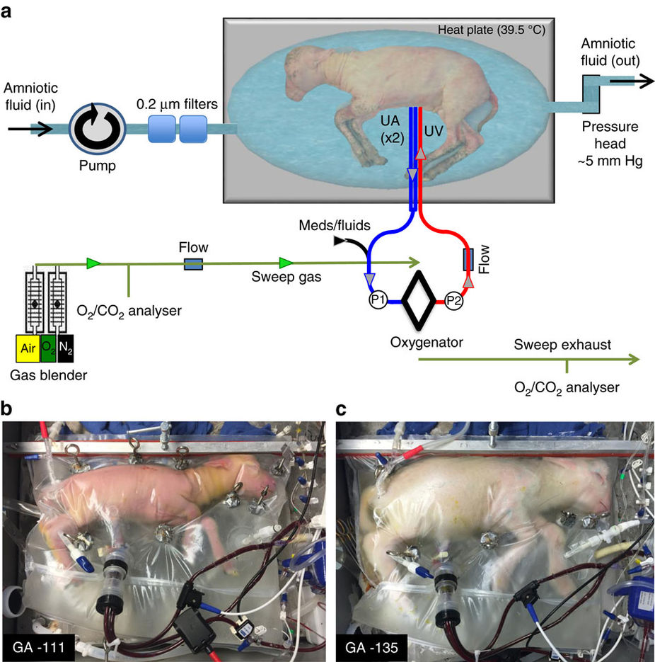 A sheep has been successfully grown in an artificial womb , it's not far off when humans can be grown in one too . 
The age when men will be able to have children without any obligation to anyone is coming soom .