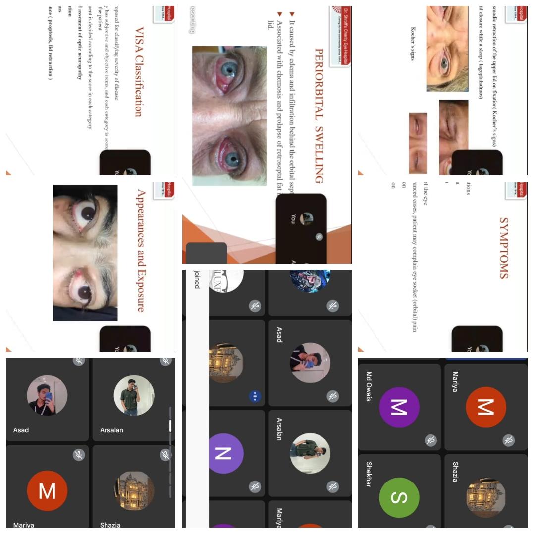 Neuroptech's tweet image. Missed the key to early TED diagnosis? 👁️ Watch this sharp snippet from our webinar with expert Ms. Sheenam Wakeel (Ocuplasty Optometrist). Thanks to @NEUROPTECH for hosting this educational event on 12/10/2025.
#ClinicalOptometry #TEDawareness  #ConsultantOptometrist #NEUROPTECH