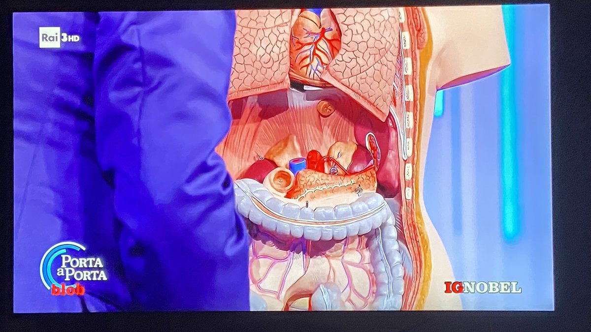 Vespino ed i suoi plastici fanno tornare al piccolo chirurgo di tanti anni fa #blob <a href="/BlobRai3/">Blob</a>