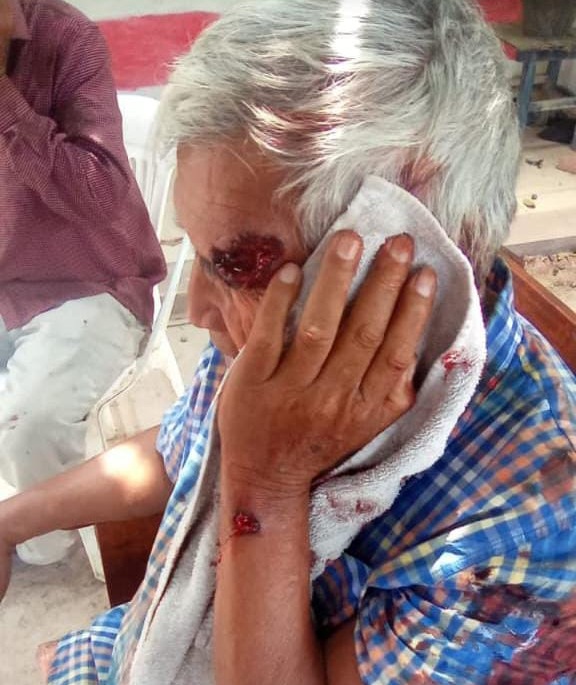 Integrantes de las comunidades Qom de Villa Río Bermejito, en Chaco, fueron brutalmente reprimidos este martes. Recamaban por la suspensión de pensiones no contributivas ordenada por el Estado nacional, una decisión que agrava la exclusión en una región ya postergada.