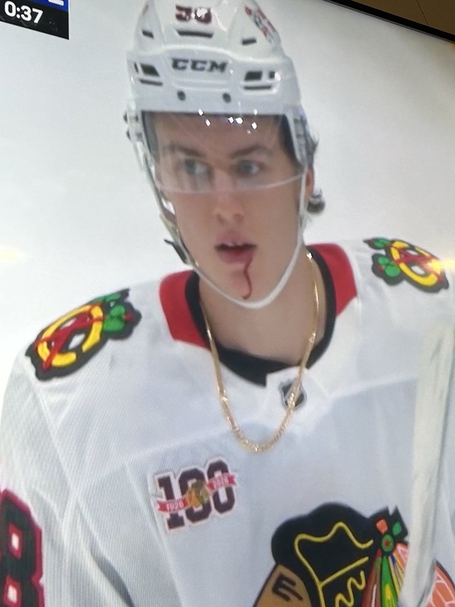 tich4141's tweet photo. @BarstoolChief @toastclark 

Did we just witness the moment  Bedard became a man? 

✅gold chain
✅leaking blood
✅5 on 3 PP https://t.co/4OsM2iCMkq