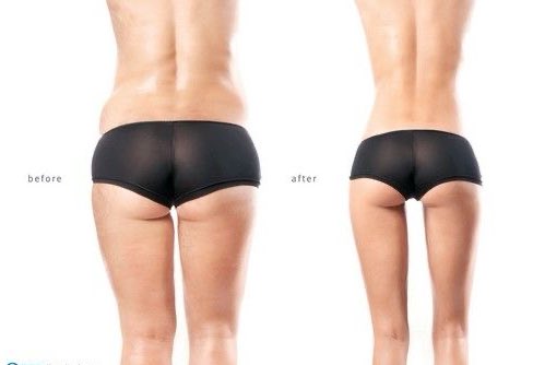 bonescontour's tweet image. lembre-se disso.