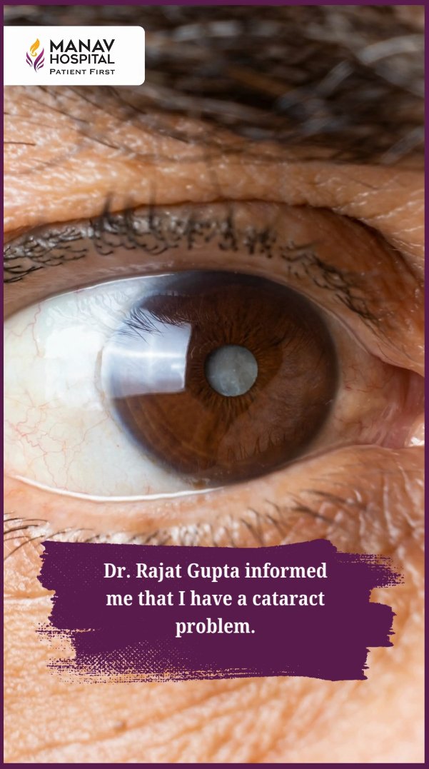👀मोतियाबिंद (Cataract) Surgery 2025✌️Cataract Surgery With Latest Lens - Tecnis PureSee IOL 
.
.
#CataractSurgery #whitecataract #LaserCataract #DrRajatGupta #ManavHospital #ClearVision #EyeCare #HappyPatient  #PureSeeIOL 
youtube.com/shorts/Q06MzT2…