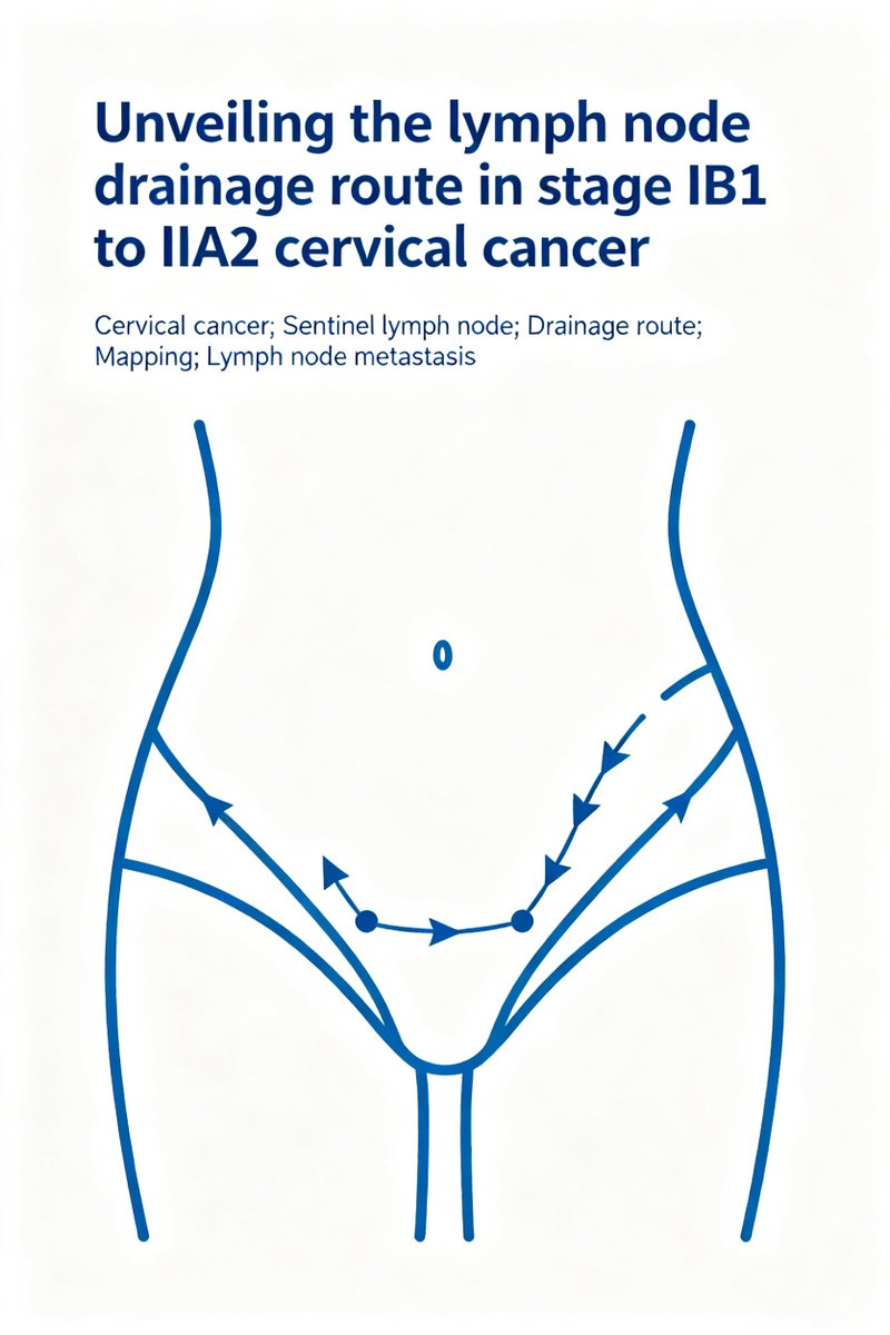 🩺Study: Internal iliac lymph nodes key first station in cervical cancer LNM, full removal vital!
📚Read more:ejgo.net/articles/10.22…
#CervicalCancer #Oncology #Research
