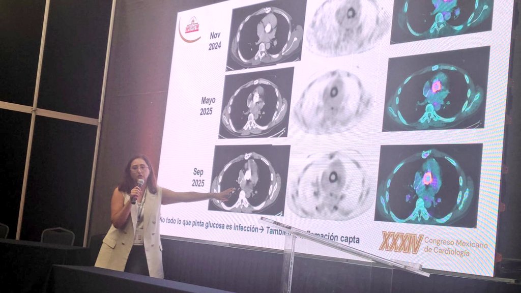 estelais's tweet photo. Participación en Congreso Mexicano de Cardiología.

La única mujer del panel😎.
The woman who breaks the manel. #CongresoSMC #womeninmedicine 

@smexcardiologia  @WomenAs1 https://t.co/8jHEMSQ2b5