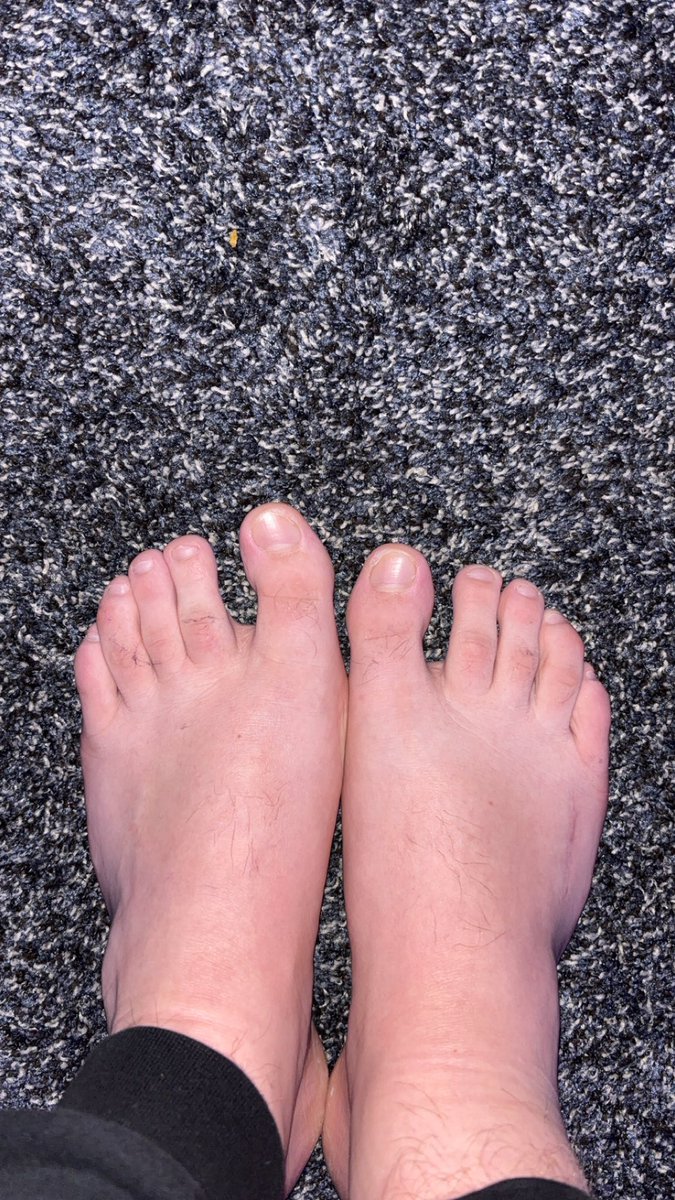 MasterLeBron623's tweet photo. fresh out the shower already with lint on my toes.... i'll be gaming for the next hour so hmu to do some drains and ignore sessions

#findom #cashmaster #alpha #master #cashapp #cashfag #fagcash #obey #sweaty #feet #sweatyfeet #skypes #drain #findomdrain #feetworship #worship #drainedwallet #feetworship #dirtyfeet #bowdown @alpha_amplifier 
 @HomiesexuaIs @brazilian_feet
@CashMastersRT @orlandofootguy
@findomfan420 @nick_gtwb
@MASTERUPDATES @findominfluence @RT4Masters2 @slave_here
@RtPromoking @RT_4_Alphas
@alphaxfindomrt @officer_rt @RT4Kings @rt_feet @RT_4_Alphas @DiscordFindom
@FindomPromoter 
@MASTERUPDATES @findominfluence
@AlphaMaleWorld1 @RT4DomMusl
@RT_4_Alphas @DiscordFindom
@FindomPromoter @rt_feet
@MASTERUPDATES @findominfluence
@AlphaMaleWorld1 @RT4DomMusl
@IslandBoyxxx @scallysketch @diamond__here @topalphamales @master_updates @f4gfunn @masterspacert @rt_feet @topalphamales