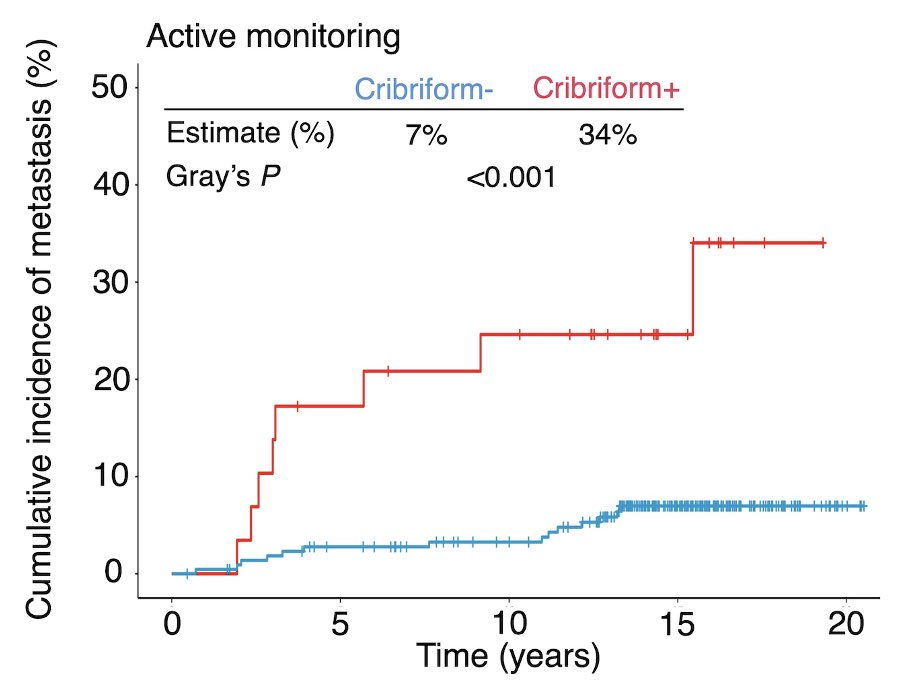 6/

🚨 ❌ Cribriform/intraductal #ProstateCancer is not safe to monitor

▶️ And for long-term (&gt;10y) prevention of metastasis, multimodality treatment may be necessary (keep reading 👇🏼)