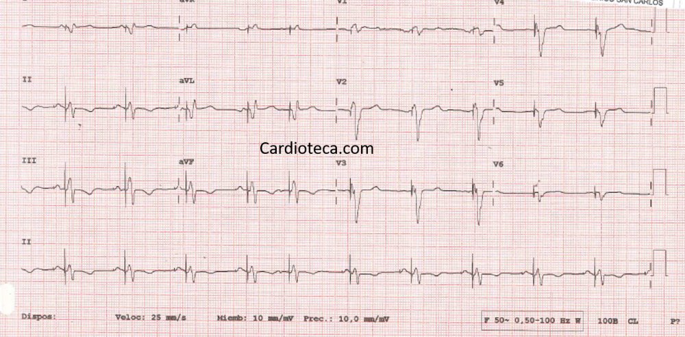 CardioTeca tweet media
