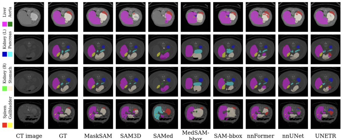 HaoTang_ai's tweet image. 🚀 Big news! Our paper MaskSAM is heading to #ICCV2025 in Hawaii! 🌺🌴

We make SAM smarter for medical image segmentation — no prompts, just mask magic 🩺✨ (+2.7% Dice on AMOS2022).

🔗 arxiv.org/abs/2403.14103

#MaskSAM #SegmentAnything #MedicalImaging #AIforHealthcare