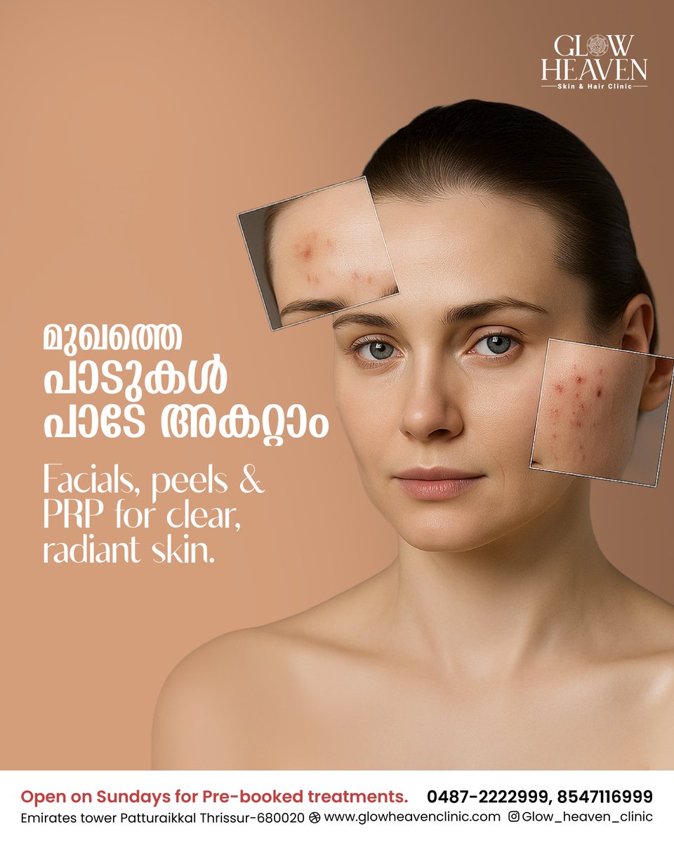 GlowHeaven's tweet photo. Clear skin is confidence you can wear 💧✨
At Glow Heaven, we treat acne marks, pigmentation &amp; scars with facials, peels &amp; PRP - for visibly glowing skin 🌸
📍 Thrissur | 💆‍♀️ Open Sundays (Pre-booked)
#GlowHeaven #SkinRejuvenation #AcneScarRemoval #ThrissurClinic https://t.co/VyXLcsnKLQ