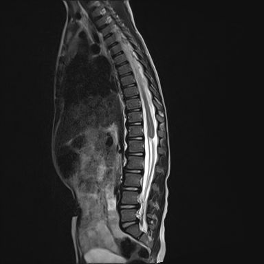 Brain, Spine & Beyond tweet media