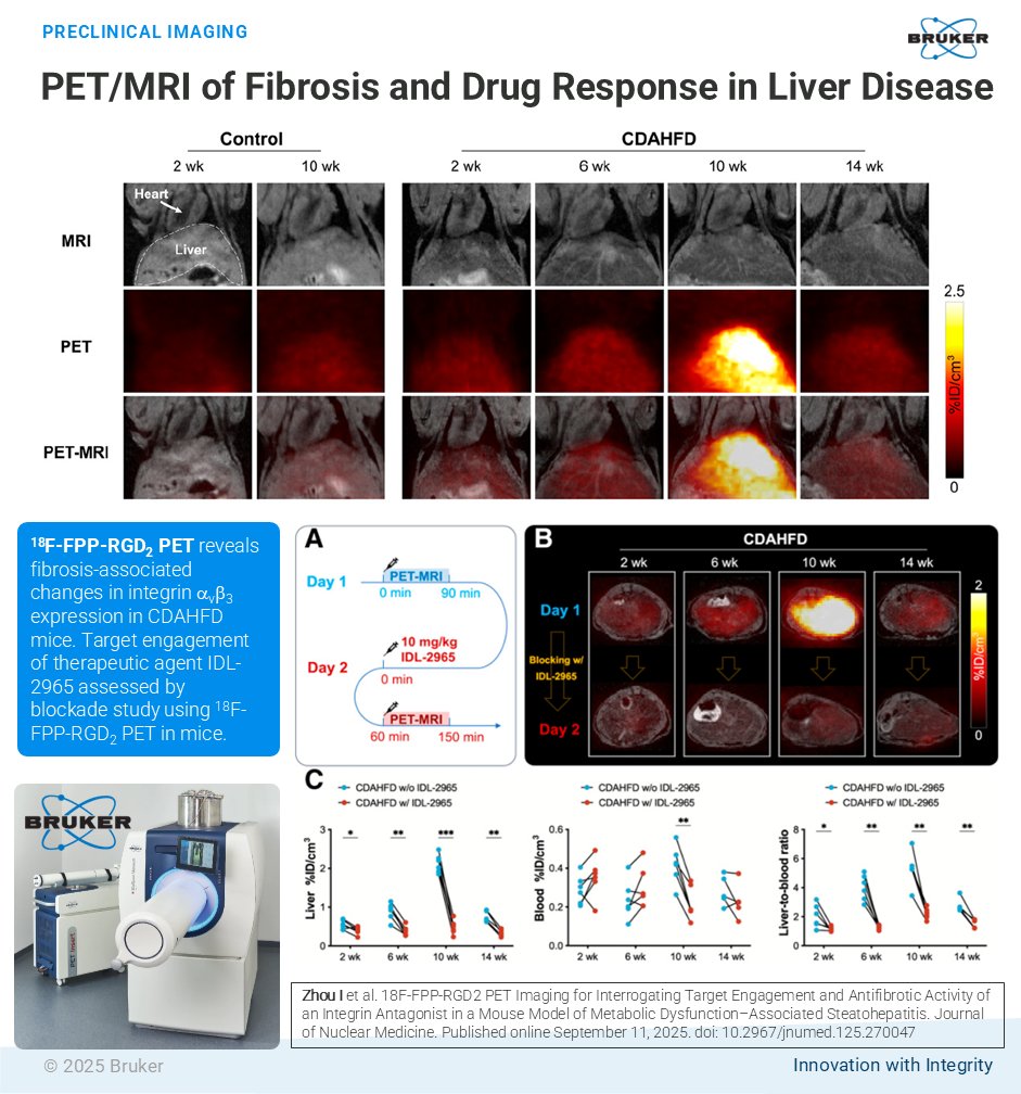 bruker's tweet image. ¹⁸F-FPP-RGD₂ PET/MRI: a powerful duo for liver disease research!
Thrilled to share the latest publication by Iris Zhou, Peter Caravan, and team (@MGHMartinos) in @JournalofNucMed.

Read the paper: goto.bruker.com/3Jj36ih

#PETMRI #MolecularImaging #LiverDisease #Fibrosis #MASH