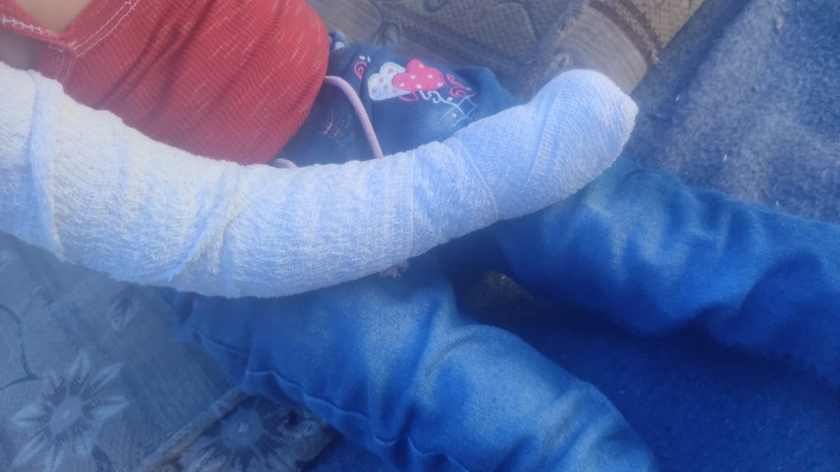 ZERODS6's tweet photo. Selamünaleyküm, kardeşlerim Diala'nın ay sonunda ameliyatı var, lütfen, tedavisiyle ilgilenebilecek ve operasyonun maliyetinden tasarruf edebilecek, bu günkü bağışınız Diala'nın hayatını kurtaracak, babasını kaybetti ve geçim kaynağı yok

https://t.co/CXrcj4lyfb https://t.co/8ZotU54kit