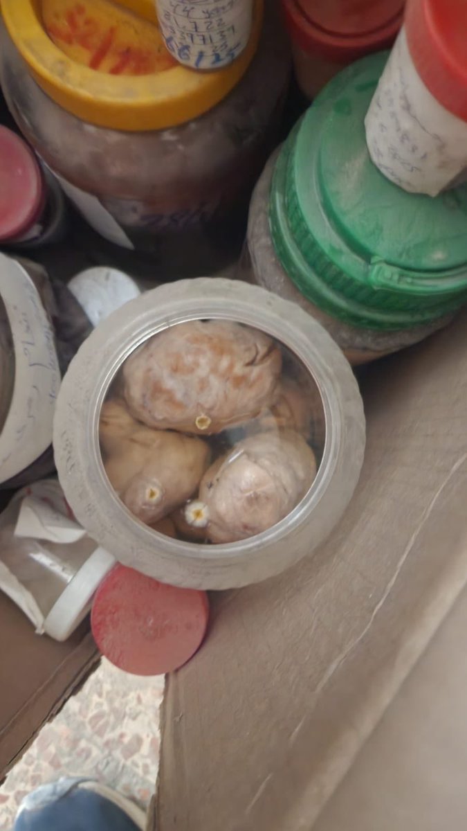 Osint613's tweet image. GAZA: Palestinians discovered a cache of well-preserved human organs inside a residence on Al-Nasr Street in Gaza City.
@Philipp27960841