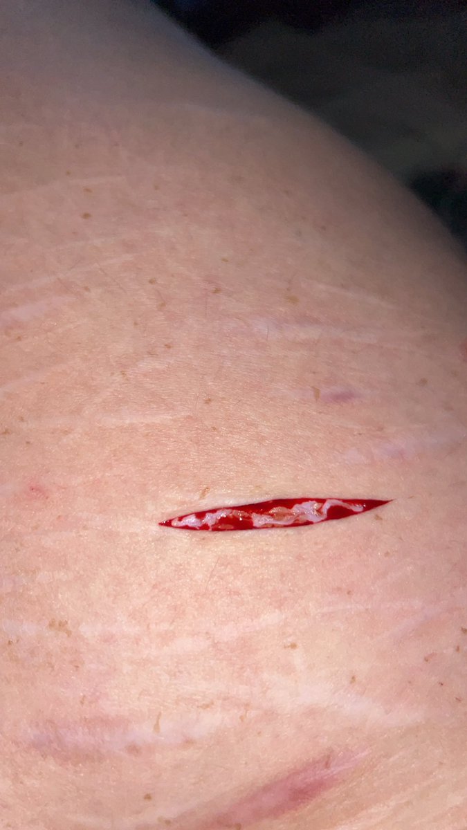 VividD0ll's tweet photo. Relapsed with baby beans, kinda ugly cuz the only razor I had was a face one https://t.co/enkojPB5G4