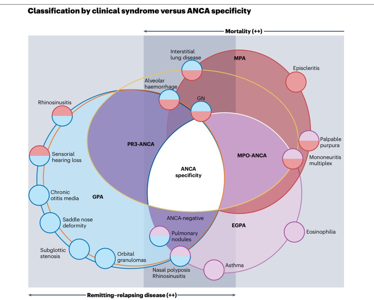 🧠 “Challenges in ANCA-Associated Vasculitis (AAV): Diagnosis, Classification &amp; Prognosis” — Key points !!

🔹 AAV = 3 intertwined diseases:
GPA 🩸 | MPA 🧬 | EGPA 🫁 — overlapping but distinct by organ pattern + ANCA specificity (PR3 vs MPO).

🔹 Diagnosis dilemma:
No gold