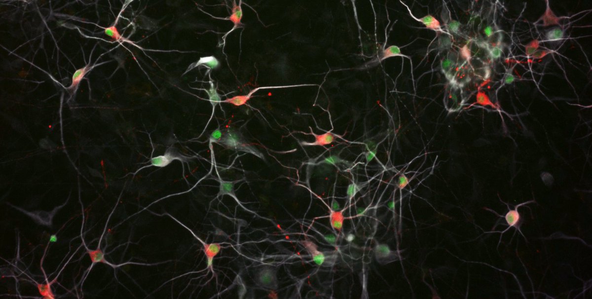 Are you interested in a PhD focused on human stem cells, neuroscience, and industry collaboration to discover new targets for obesity? If so, check out this exciting joint project between the University of Cambridge and AstraZeneca: bit.ly/4otdwLm. Thanks for sharing!