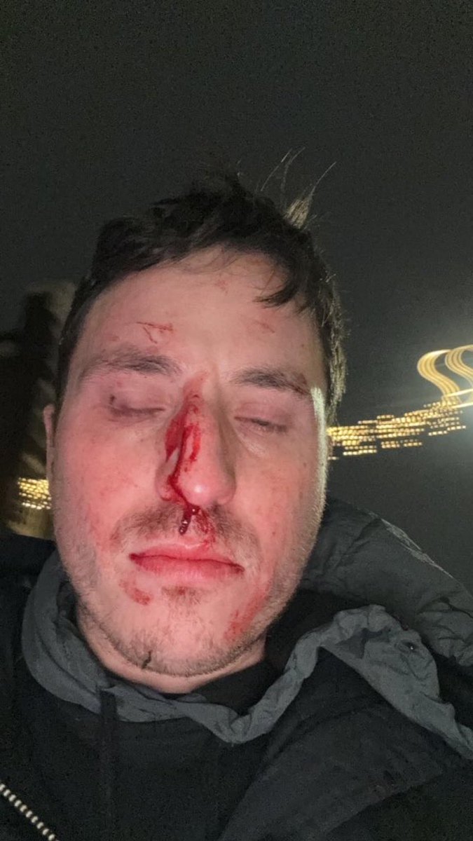 The pro-Pals cite Amsterdam as the reason for banning Israeli football fans. Remember Aaron from London who stepped in to help Tel Aviv Maccabi fans who were being beaten up there. The “Jew-hunt” was organised for days by thugs who called Jews a “cancer”. Stop victim-blaming.