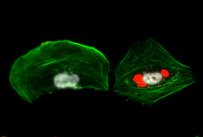 jonlg5's tweet photo. Launching #MonthCellPic! 📸🔬 I’ll share Cell Biology &amp; Histology pic every month. Today glioblastoma cells showing: 🟩 Actin, 🔴 β-catenin, ⚪ nucleus. The beauty of confocal microscopy in 1 image!
Hilero nik ateratako argazki bat ekarriko dut👨‍🔬 Gaur burmuineko minbizi zelulak! https://t.co/p1ACmQe1yd