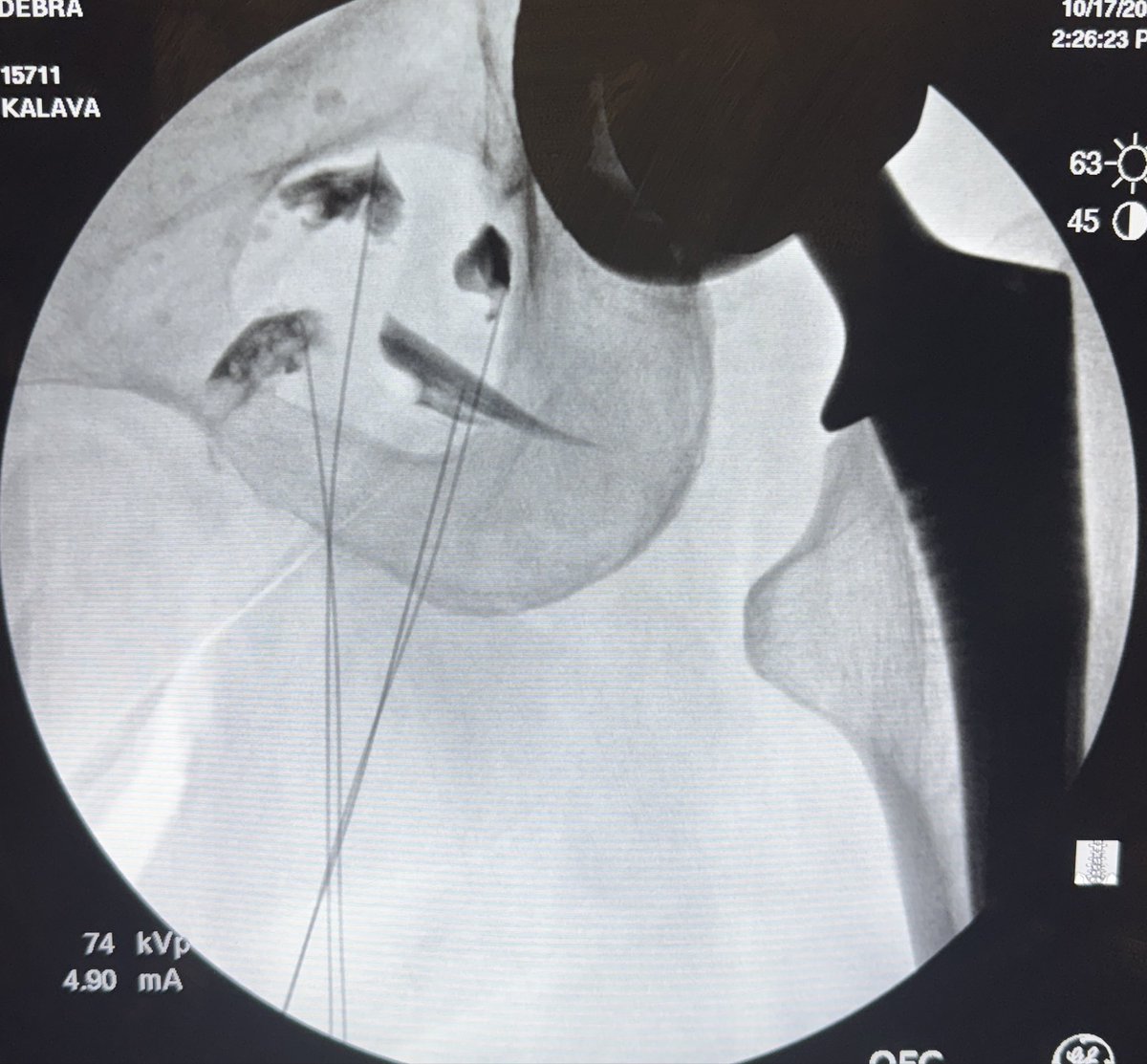 Arun Kalava MD, EDRA tweet media