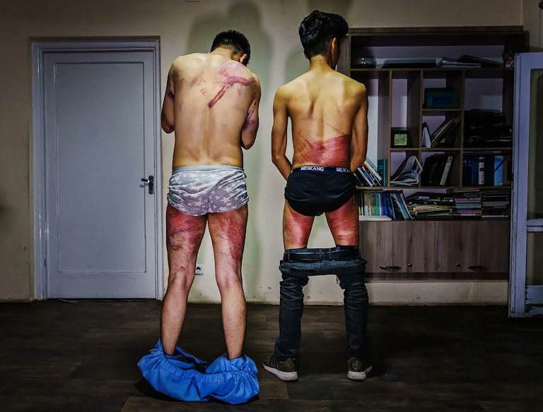 thecaravanindia's tweet photo. Archives | Nematullah Naqadi and Taqi Daryabi were tortured at a police station for reporting on a women's march in Kabul on 8 September.

“It was worth it,” Naqadi, who still has trouble seeing and hearing, told me. “It was an important event in history. It was important to give voice to the women.”

Read more on how the Afghan media navigates Taliban rule by Ezzatullah Mehrdad @EzzatMehrdad:  
https://t.co/SWv9xAAcxR #Taliban #Journalism 

Photograph by Marcus Yam/ Los Angeles Times/ Getty Images