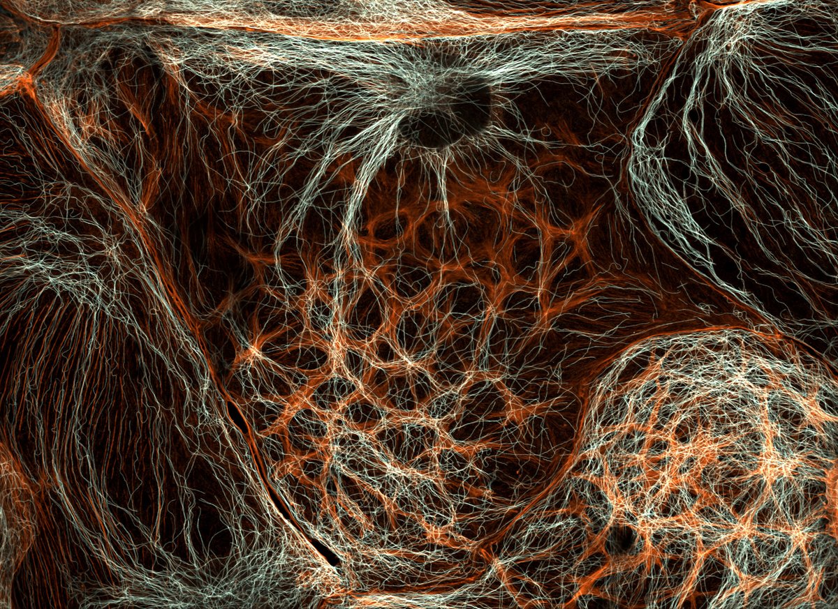 nicolashubacz's tweet image. A Real Image of a Liver Cell
This isn’t art — it’s a real microscopic image of a rat liver cell. The glowing filaments are actin and microtubules, the framework that lets the liver filter, detoxify, and regenerate.
The liver is a quiet overachiever:
🩸 Filters ~1.4 L of blood…