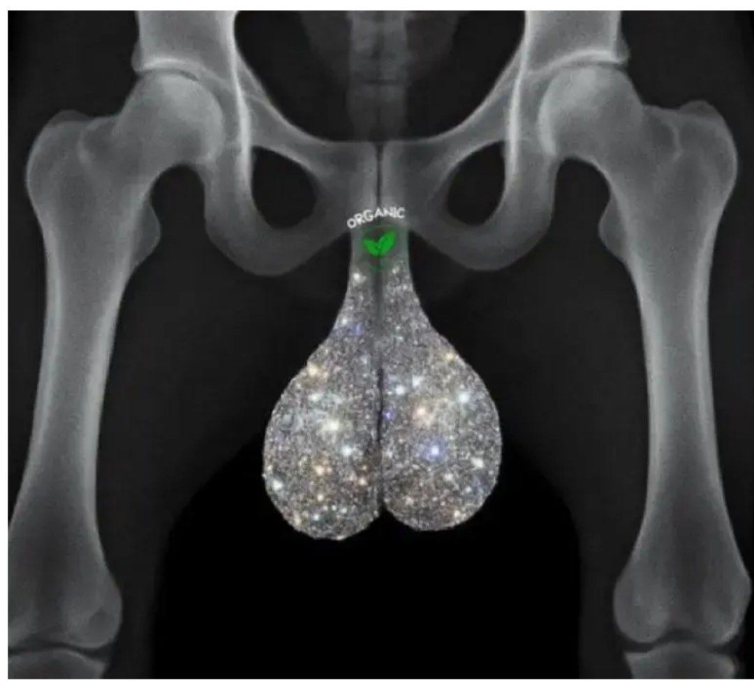 DroidHustlerOG's tweet image. recent xray of the $30C Jan $U whale
@TheRoaringKitty
$Unity EdhTCqUxXRWQcUd5Fonyz9rapHAB6mABAuVkmPrtpump