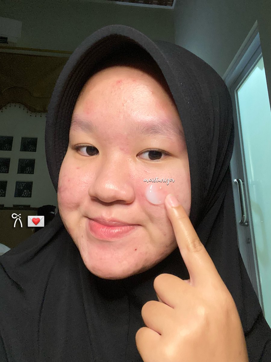 asyabetmud's tweet image. stop percaya sama pelembab yang cuma kasih sensasi “basah”, karna afternya kulit tetep kering tiap abis pakai 😞

tapi aku udah nemu moist yang beneran ngasih lembap + hidrasi ke dalam kulit 🤍🤏🏻