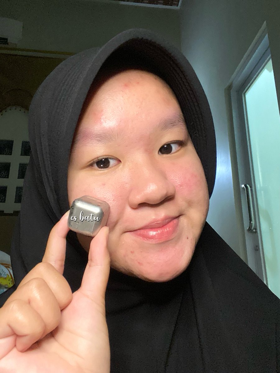 asyabetmud's tweet image. stop percaya sama pelembab yang cuma kasih sensasi “basah”, karna afternya kulit tetep kering tiap abis pakai 😞

tapi aku udah nemu moist yang beneran ngasih lembap + hidrasi ke dalam kulit 🤍🤏🏻