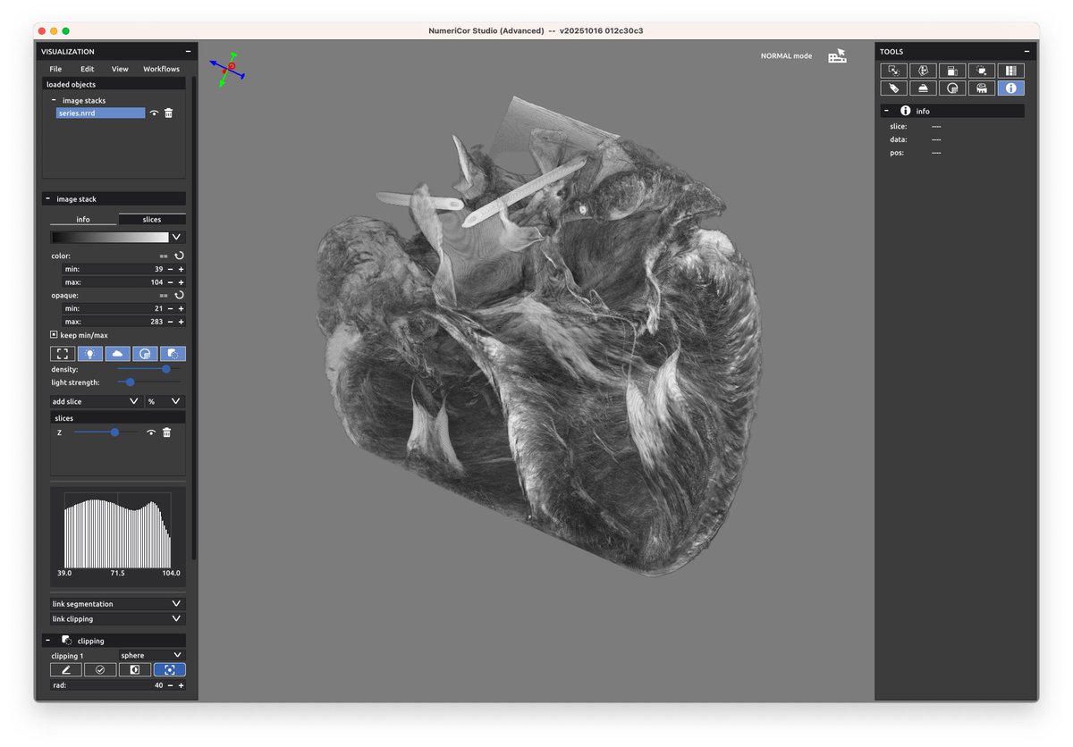 AurelNeic's tweet photo. MicroCT of a pig heart, rendered as a volume. I like the detailed fiber-structure. https://t.co/YfNbNBrXPR