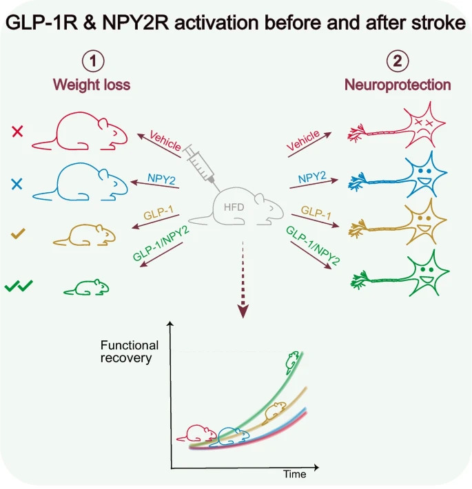 DiabetologiaJnl's tweet photo. Results in a mouse model indicate that clinically used type 2 diabetes treatments could be employed preventively to improve stroke outcome by exerting dual pharmacological action: weight loss and acute neuroprotection #T2D #DiabetesResearch https://t.co/t5OEIfOc5o 🔓 https://t.co/38t94GyAxY