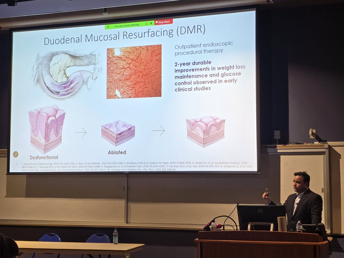 SanyaGoswami4's tweet image. Highly educational and cutting edge @wvudeptofmed Grand Rounds presented by Dr. @shailsingh on novel endoscopic therapy in the realm of #obesitymedicine
#WomeninGI #AEF