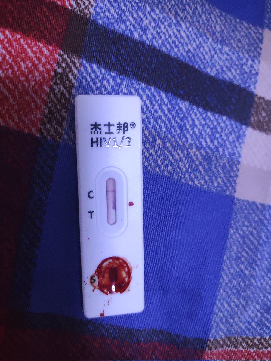 大家千万不要把刮毛刀放在床上（虽然可能一般人不会像我这么傻）
血的教训（）
睡觉之前关了灯看不见想起身下意识用手肘把自己撑起来的时候肘到刮毛刀上面了（xwx）
然后就出现了比创可贴还大的伤口还出了不少血，于是顺手把之前一直不敢自己扎自己手指所以没测的HIV测了（x）
不疼（确信）