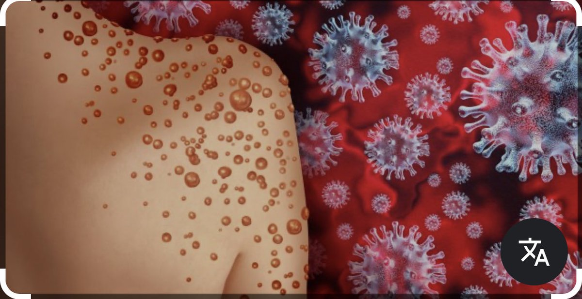 LordCache_'s tweet image. #MPoxVirus 👀👀⚠️⚠️⚠️