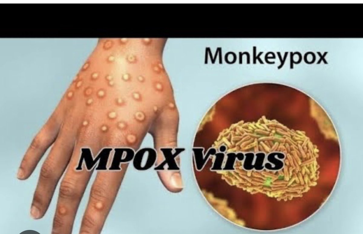 LordCache_'s tweet image. #MPoxVirus 👀👀⚠️⚠️⚠️
