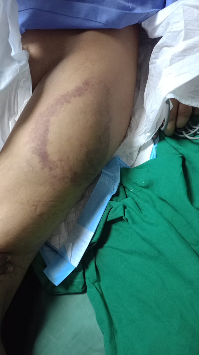 KhanIrfan111837's tweet photo. @GujaratPolice @CMOGuj My cousin sister, Tabassum Khan, was brutally beaten by her husband Jaheeruddin &amp; in-laws in Udhna, Surat over dowry demands. She was pregnant, went into a coma &amp; sadly passed away. https://t.co/yxkUtPGYO4