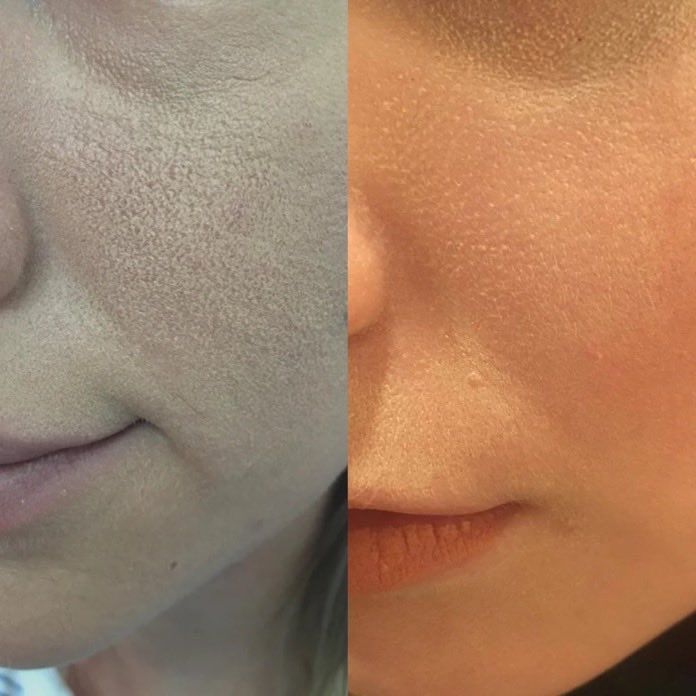 raneemalsh21's tweet image. بنات شفتوا منظر الكونسيلر و الفاونديشن لما يطلع لكم كذا متكتل وجاف؟ بحط لكم بهالثريد وش الأسباب و بطريقه مره سهله كيف نخلي منظر البشره بشكل مره صحي وقلويّ و بدون تكتلات✨