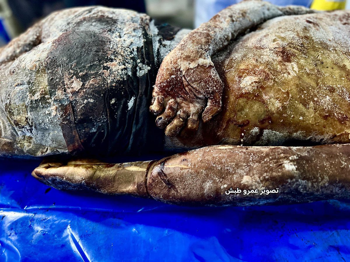 RamAbdu's tweet photo. Preliminary observations following the examination of Palestinian bodies recently handed over by the Israeli army:

• All the bodies remain largely intact and show no full signs of decomposition — indicating they were kept in low-temperature freezers, likely frozen.
• Many show evidence of having been buried and later exhumed before being placed in cold storage.
• One body appears to belong to an injured man — an IV line is still attached to his hand, suggesting attempts to keep him alive before execution.
• A large number were found with their hands and feet bound using plastic zip ties.
• Some of the bodies belong to elderly men.
• In many cases, the victims were blindfolded and restrained before being killed — confirmed by burn marks where fabric had fused to the skin.
• The method of binding resembles the torture and restraint practices previously inflicted on Palestinian workers following the October attack.