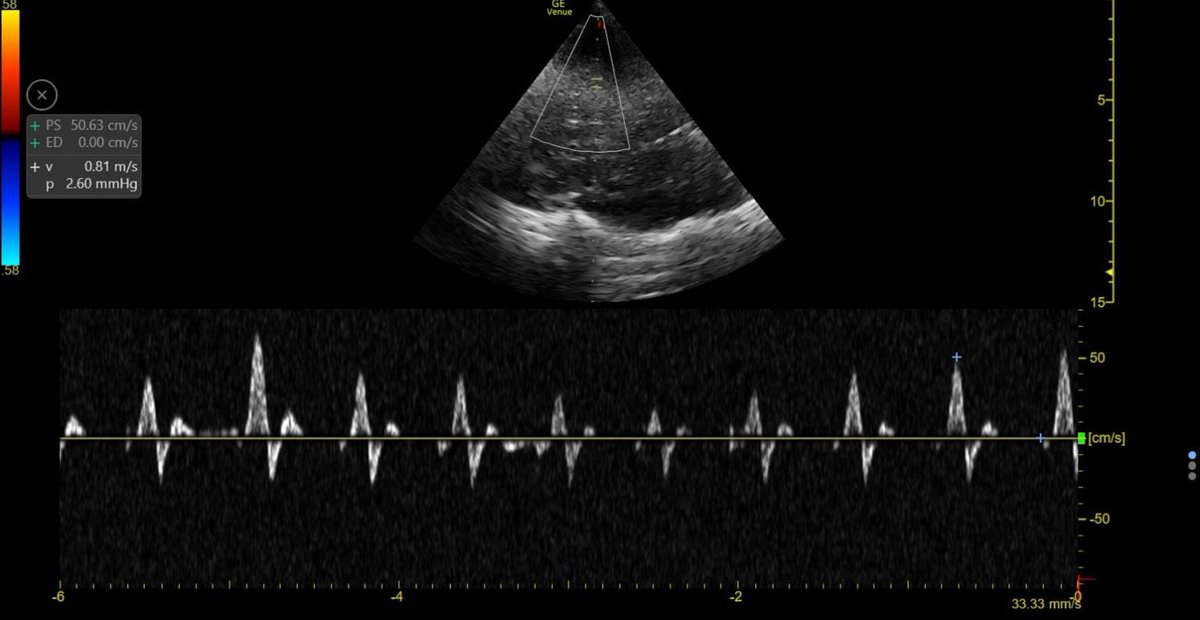 Mohan Sai Gudela, DM tweet media