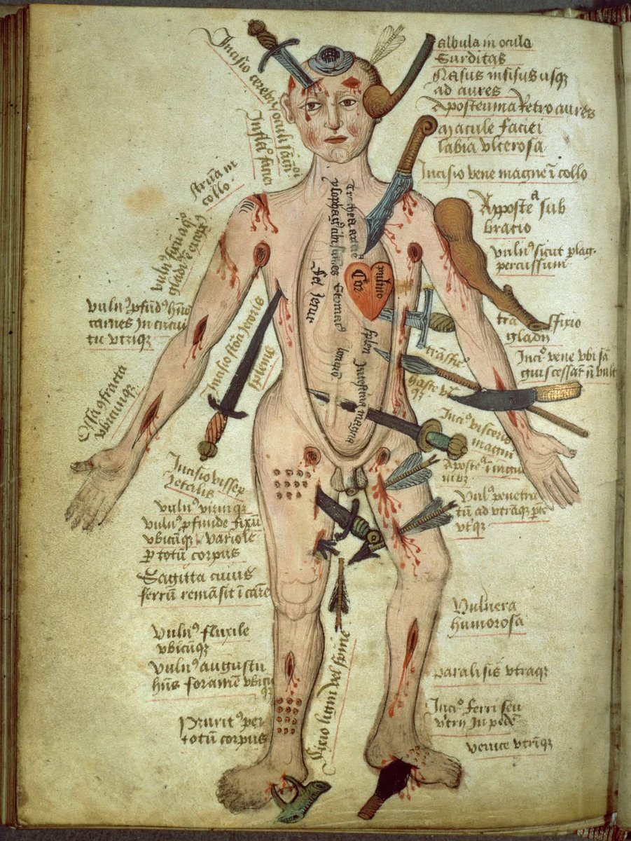 “Wound Man” is an illustration which first appeared in European surgical texts during the Middle Ages. It laid out schematically the various wounds a person might suffer in battle or in accidents, with accompanying text stating treatments.