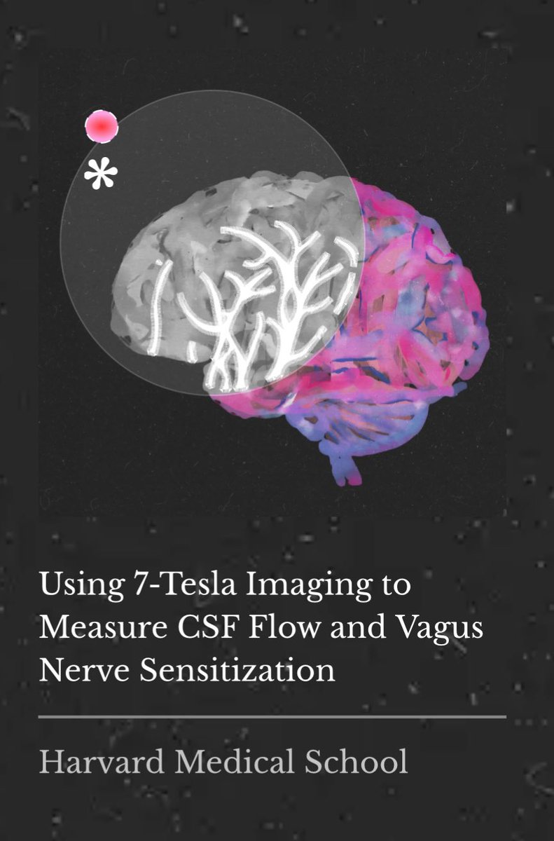 polybioRF's tweet photo. 2/ PolyBio is supporting the Van Elzakker lab’s work to assess the role of the brainstem & vagus in Long COVID and ME/CFS symptoms including dysautonomia, diffuse pain, sleep problems, flu-like symptoms, and nausea. The Martinos Center’s 7-Tesla MRI scanner allows for the most detailed neuroimaging in the world & will be used to study structural issues and problems with blood and CSF flow that simply cannot be seen with other MRIs.

https://t.co/aNgJXswCWj