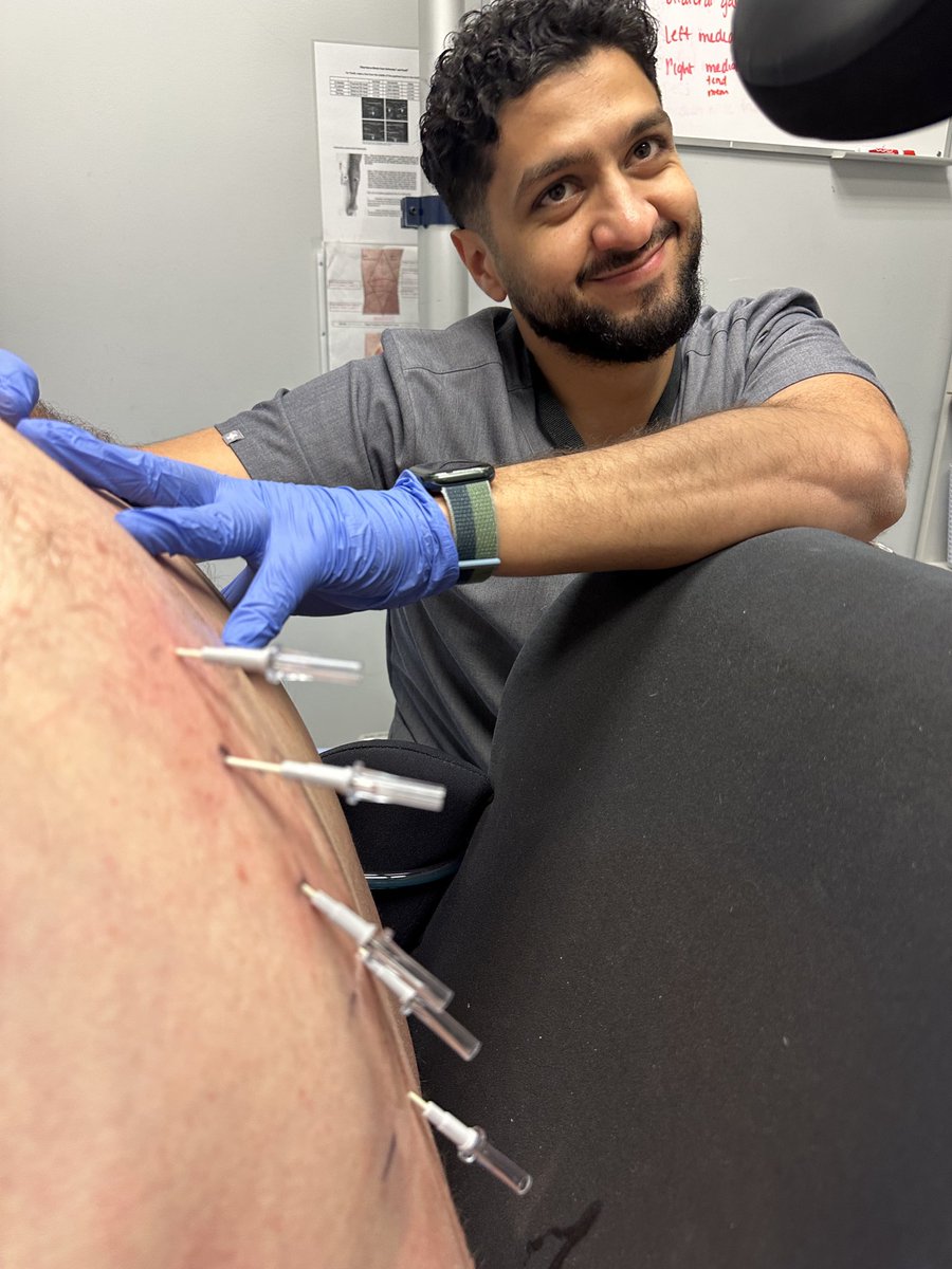 drpaulwinston's tweet image. Welcome to our medical student from Bahrain, who is a proud Newfoundlander and active member of our military, planning to come home for residency #internationaldayofPain #spinalcord injury multilevel cryo for spinal cord pain.